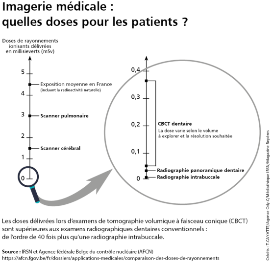 Imagerie médicale : quelles doses pour les patients ?